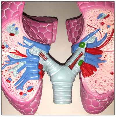 Plastik KOAH Akciğer İnsan Vücut Organları Modeli Viseral Öğrenme 19x13x17 cm